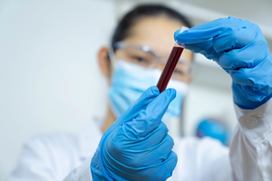 Asian scientist working on platelet-rich-plasma therapy.
